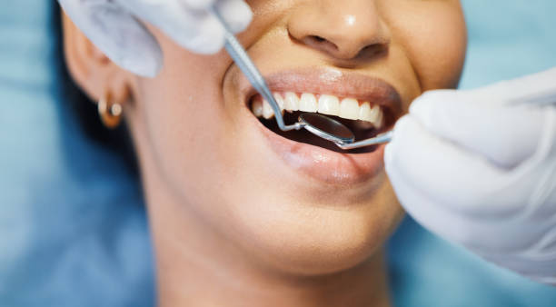 Best Tooth Infection Emergency Dentist  in Los Gatos, CA